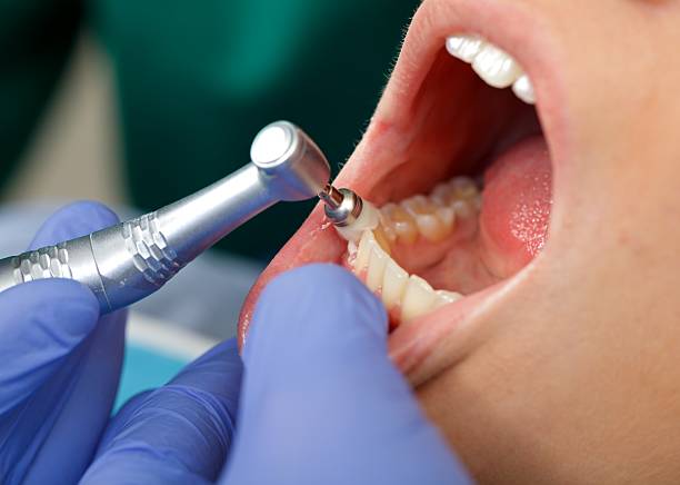 Our Range of Dental Services in Encinitas, CA